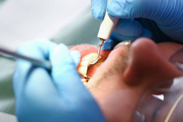 Best Emergency Dental Care for Trauma or Injury in Ganado, TX