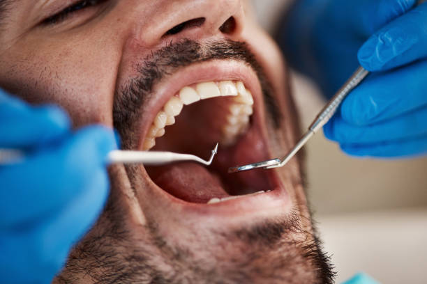 Best Emergency Tooth Extraction in Ganado, TX