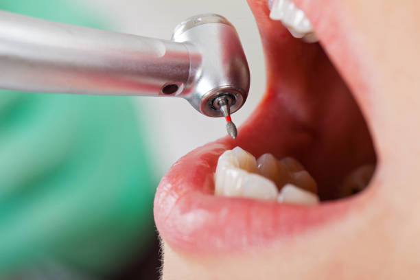 Best After-Hours Emergency Dentist in Ganado, TX